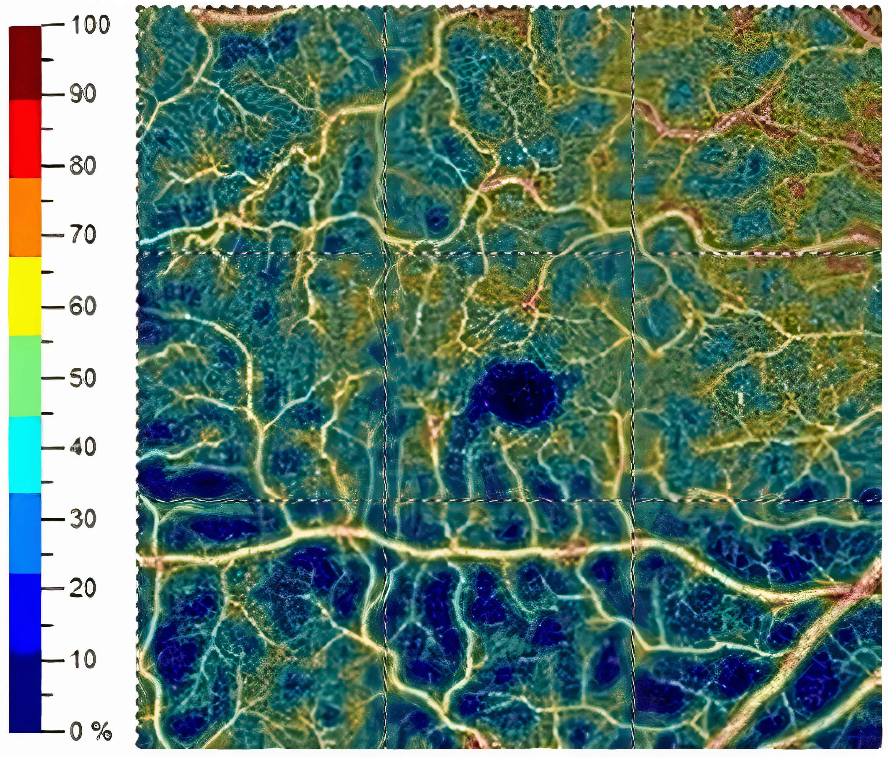 Cartographie de la densité vasculaire de la macula en OCTA