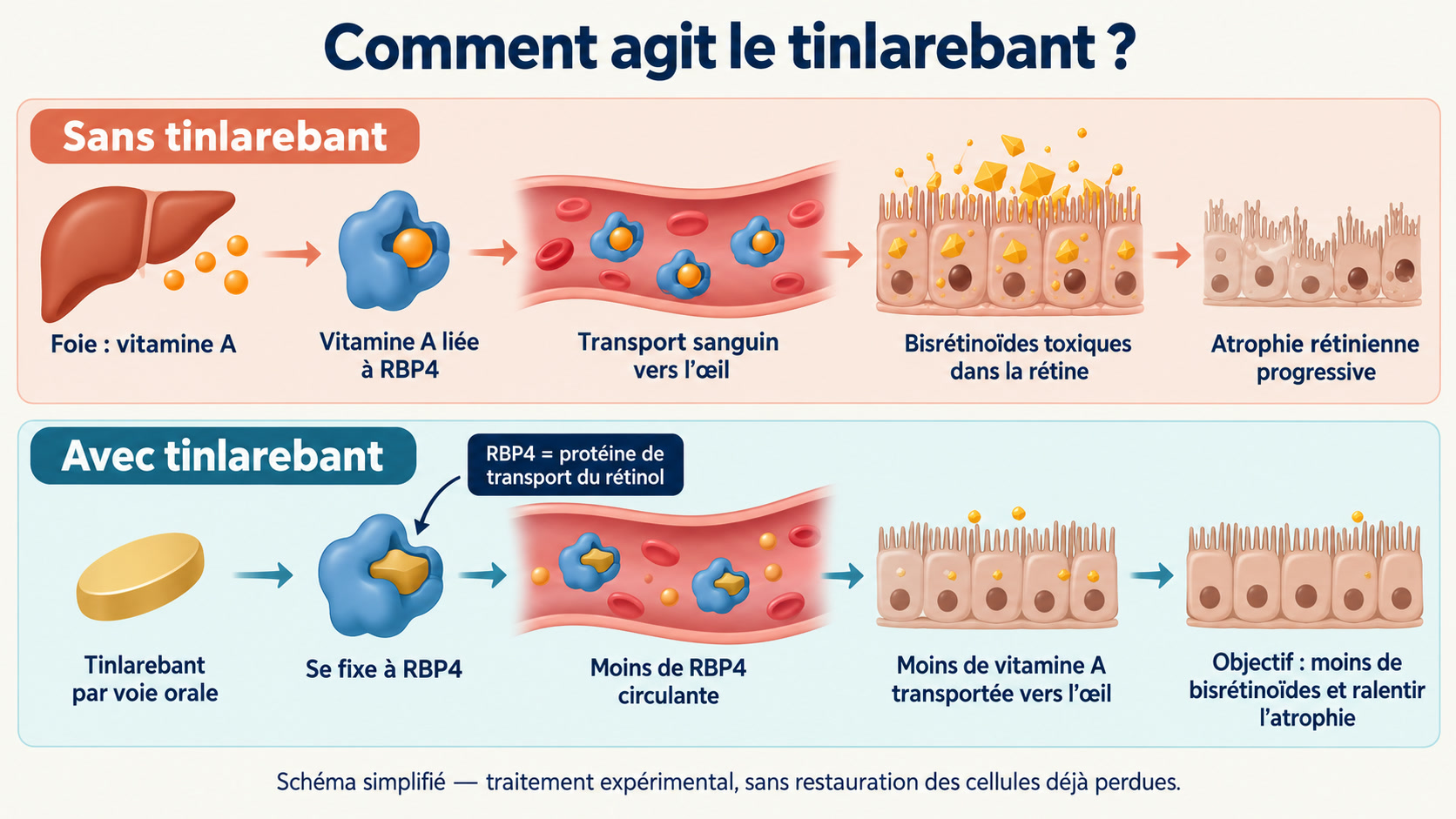 Schéma du mécanisme du tinlarebant montrant la diminution de RBP4 circulante et du transport de vitamine A vers l'œil