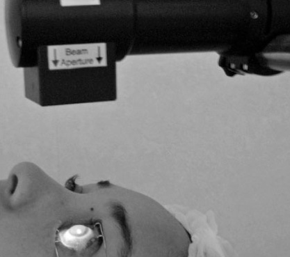 Cross-linking cornéen : source UV en cours de traitement